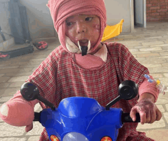 {{brizy_dc_image_alt entityId=